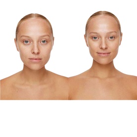 Universal Glow Treatment SPF30