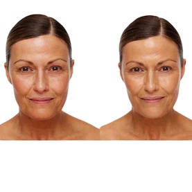 Universal Glow Treatment SPF30