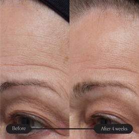 Pro-Collagen Future Restore Serum