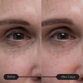 Pro-Collagen Future Restore Serum