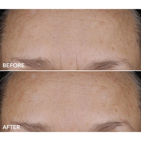 DermInfusions Blur and Repair Cream