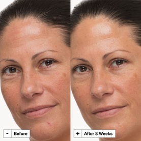 Prejuvenation Firming Bakuchiol Cream