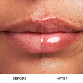DermInfusions Plump, Fill and Repair Kit