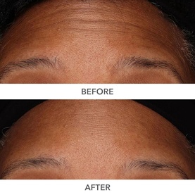 DermInfusions Plump, Fill and Repair Kit