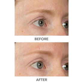 DermInfusions Plump, Fill and Repair Kit