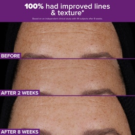 Clinical Pro Retinaldehyde Dual-Retinoid Treatment