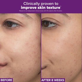 Clinical Pro Retinaldehyde Dual-Retinoid Treatment