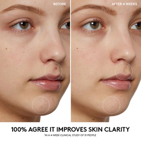 Cherry Dub Pore Purify&rsquo;r Gel Cleanser