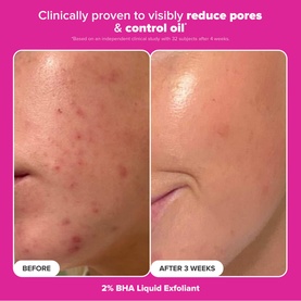 The Plump and Glow Kit