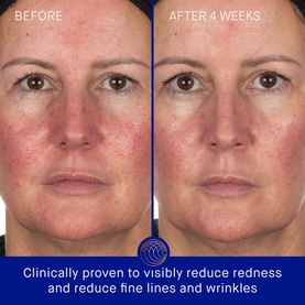 The Hydrogel Face Mask 6 Pack
