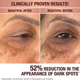 Dark Spot Correcting Radiance Recovery Serum