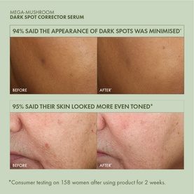 Mega-Mushroom Dark Spot Corrector Serum