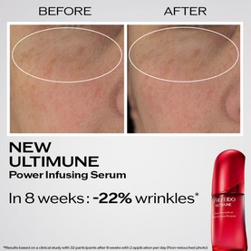 Ultimune Power Infusing Serum Refill