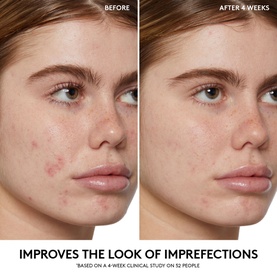 Cherry Dub BHA Toner