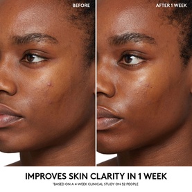 Cherry Dub BHA Toner