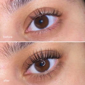 Eyelash Serum