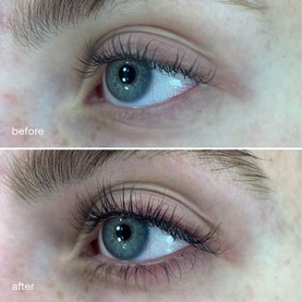 Sensitive Eyelash Serum