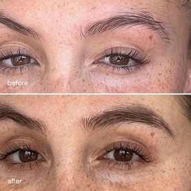 Eyebrow Serum