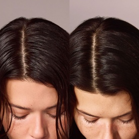 Super Dry Shampoo, Melrose Place
