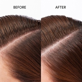 Pure Genius 98% Natural Scalp Restoring Oil