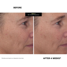Mega-A Skin Transforming Serum
