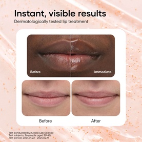 Bouncy & Firm Lip Treatment