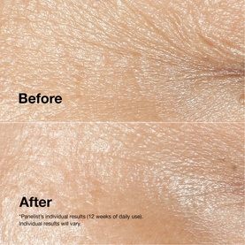Smart & Smooth: Smart Clinical Repair Gift Set