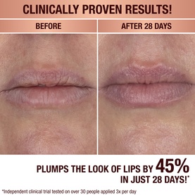 Life Changing Lip Mask