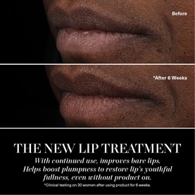 Lip Balm Treatment