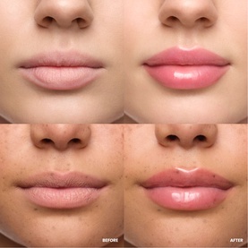 Lip Relapse Plumping Gloss