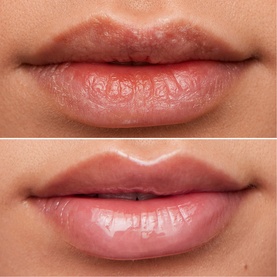 Lip Rehab Serum Oil