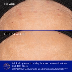 The Vitamin C Serum