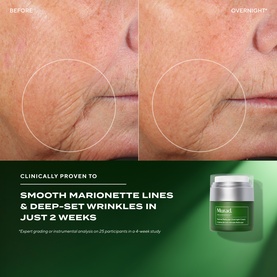 Retinal ReSculpt&trade; Overnight Cream