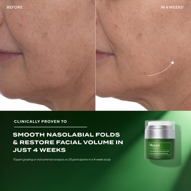 Retinal ReSculpt&trade; Overnight Cream