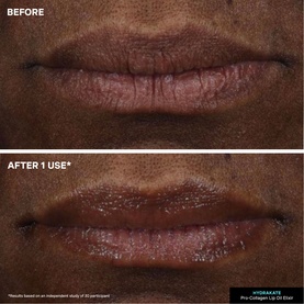 HydraKate Pro Collagen Lip Oil Elixir
