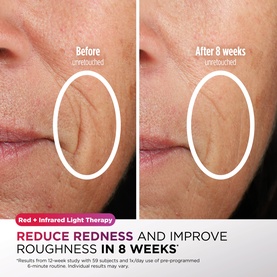 CryoGlow Under-Eye Cooling + LED Mask - Lilac Chill