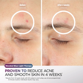 CryoGlow Under-Eye Cooling + LED Mask - Lilac Chill