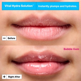 Vital Hydra Solution&trade; Hydrating Lip Mask