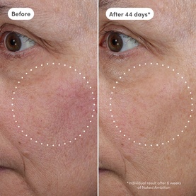 Naked Ambition Azelaic Exosome + Vitamin C Serum