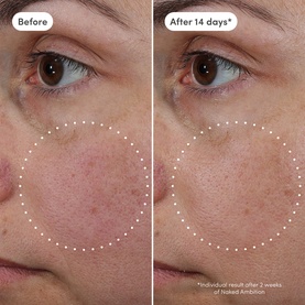 Naked Ambition Azelaic Exosome + Vitamin C Serum