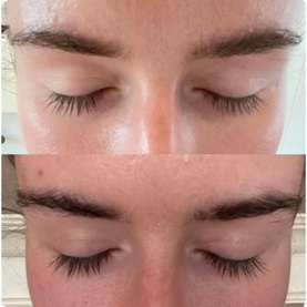 ProGrowth Eye Lash Serum