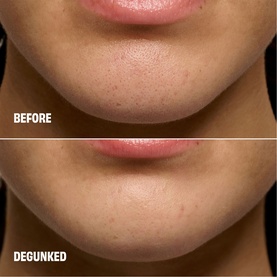 The Porefessional Degunker Blackhead and Pore Cleansing System for Clogged Pores