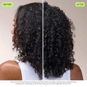 Scalp Care Essentials Set