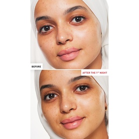 Skin Therapy