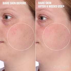 The Porefessional Hydro Pop Pore Essence