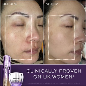 R&eacute;nergie Triple Serum Retinol 50ml Set