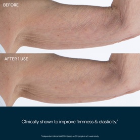 Elemis Pro-Collagen Marine Body Cream before and after arm skin comparison showing improved firmness and elasticity after one use.