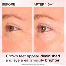 Retinol + HPR Ceramide Rapid Skin Renewing Eye Cream