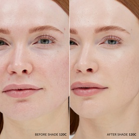 Skin Base