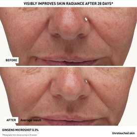 Ginseng Micro Shot Advanced 0.3%